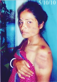 Bangladesh Hindu Victim