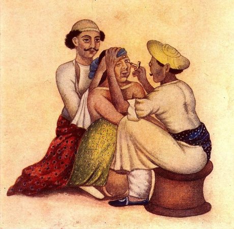 Couching for cataract by Indian doctors.